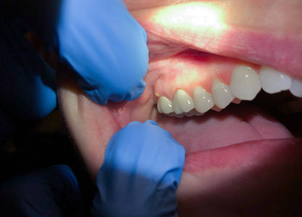 Best Teeth Whitening  in New Oxford, PA