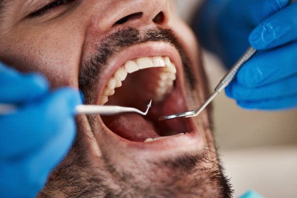 Best Dentist for Tooth Abscess  in New Oxford, PA